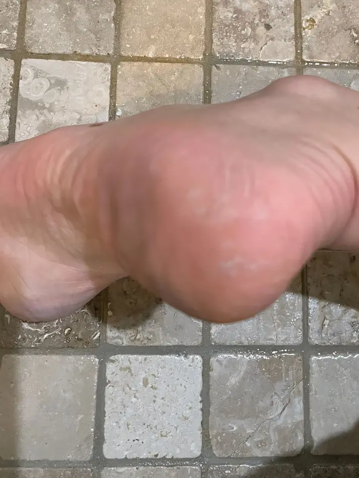 Feet after Maundy application